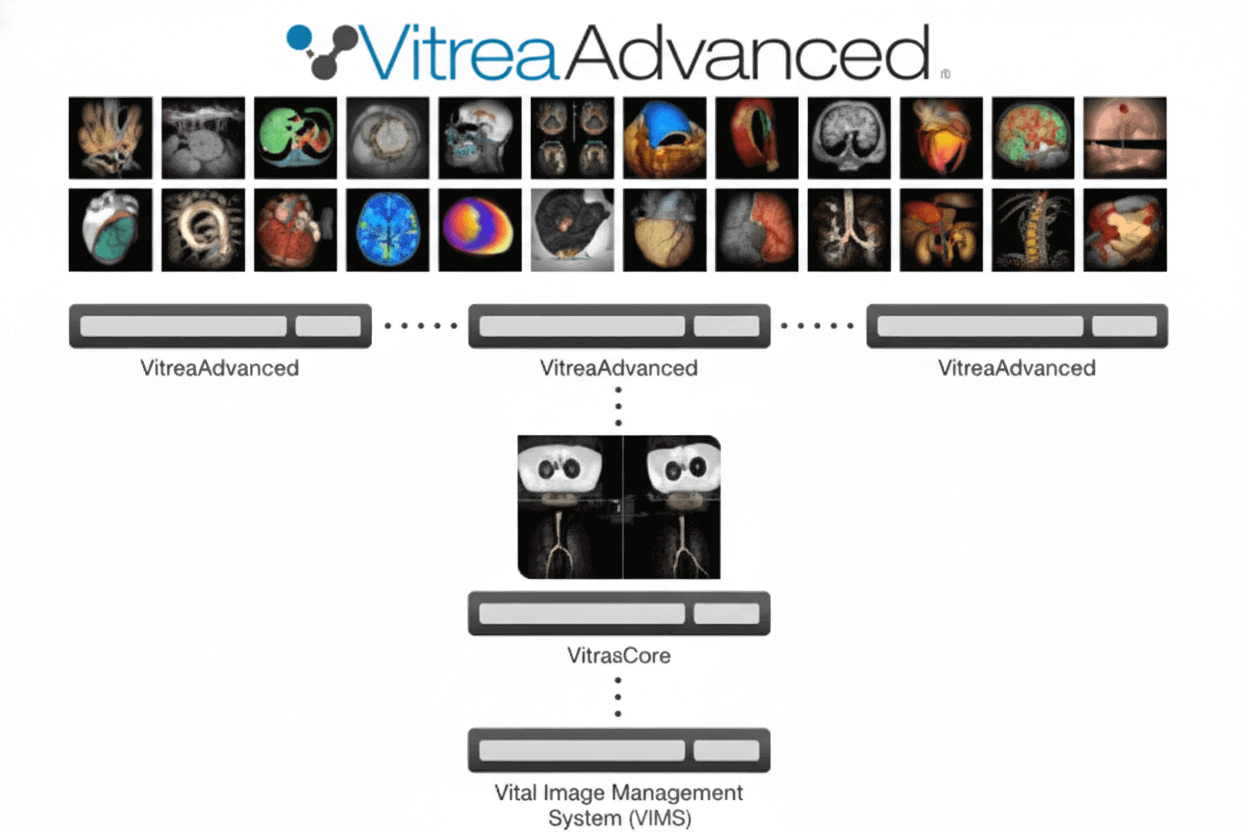 Vitrea 3D visualization software interface